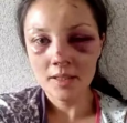 «Езжай в свою Россию»: Дело об этническом избиении пытаются замять